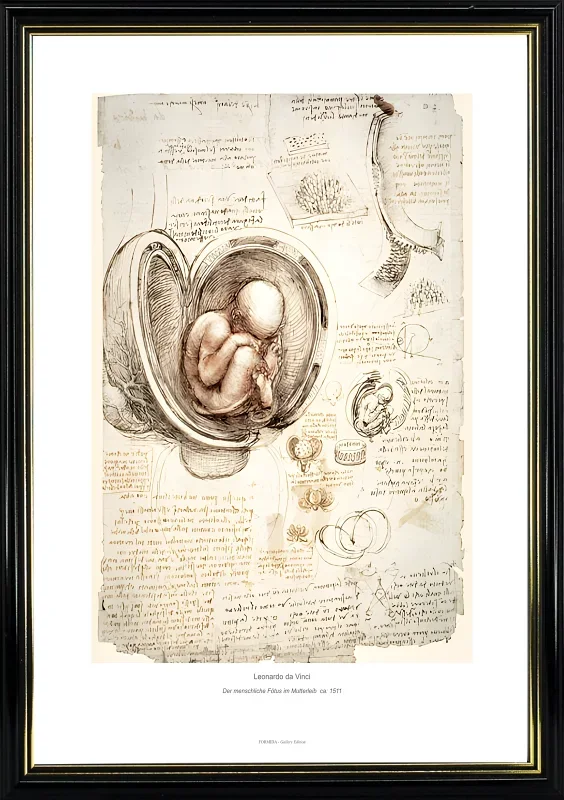 Leonardo da Vinci | Der menschliche Fötus im Mutterleib - 1511 | Gallery Edition | Gerahmter Kunstdruck | Renaissance