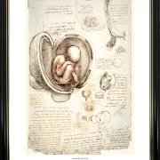 Leonardo da Vinci | Der menschliche Fötus im Mutterleib - 1511 | Gallery Edition | Gerahmter Kunstdruck | Renaissance