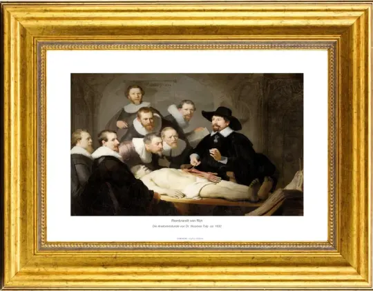Rembrandt van Rijn | Dr. Nicolaes Tulps anatomi-lektion - 1632 | Gallery Edition | Indrammet kunsttryk | Barok